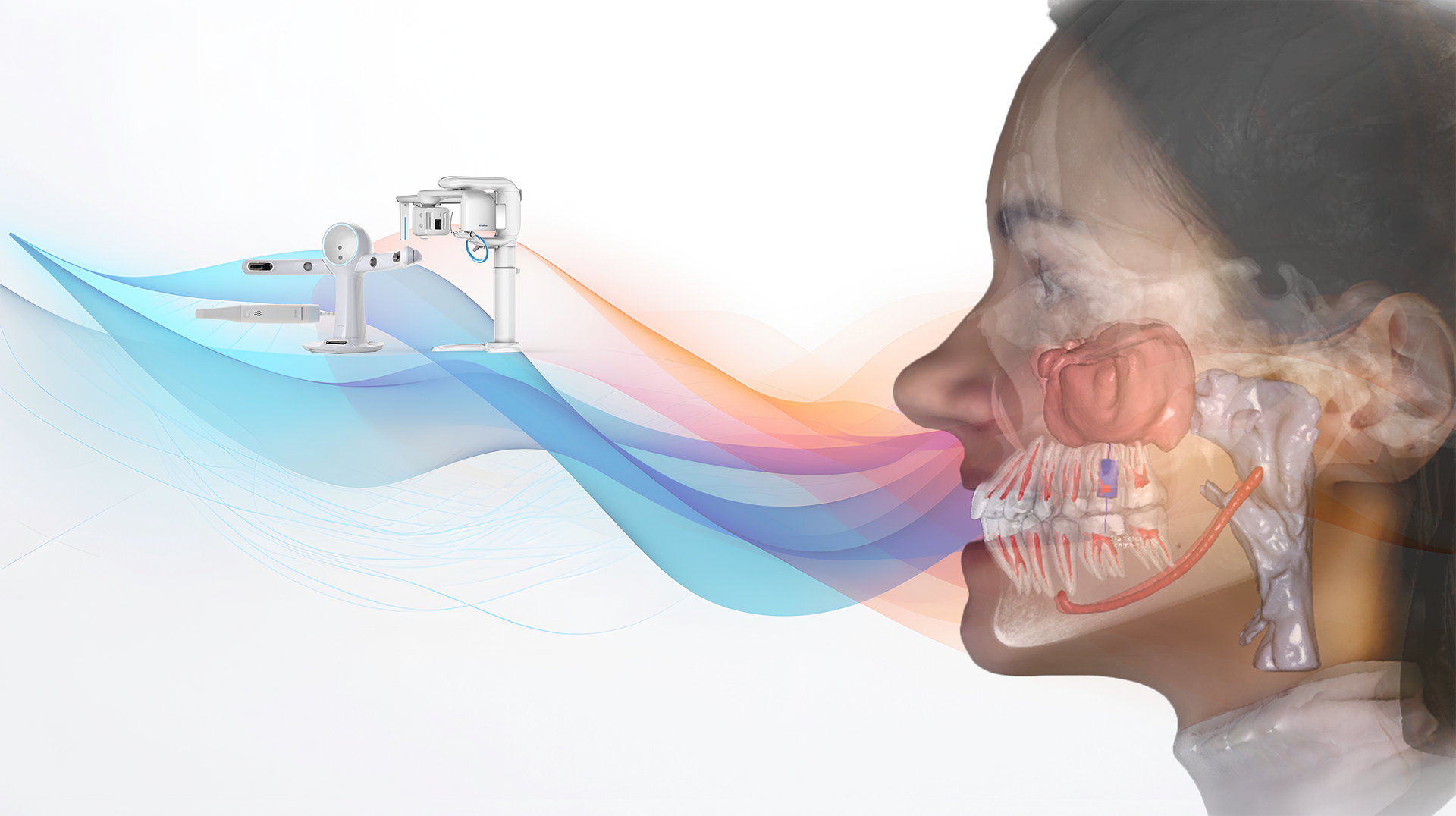 Datenfusion aus Face Scan, IOS und DVT zum anatomischen Patientenmodell