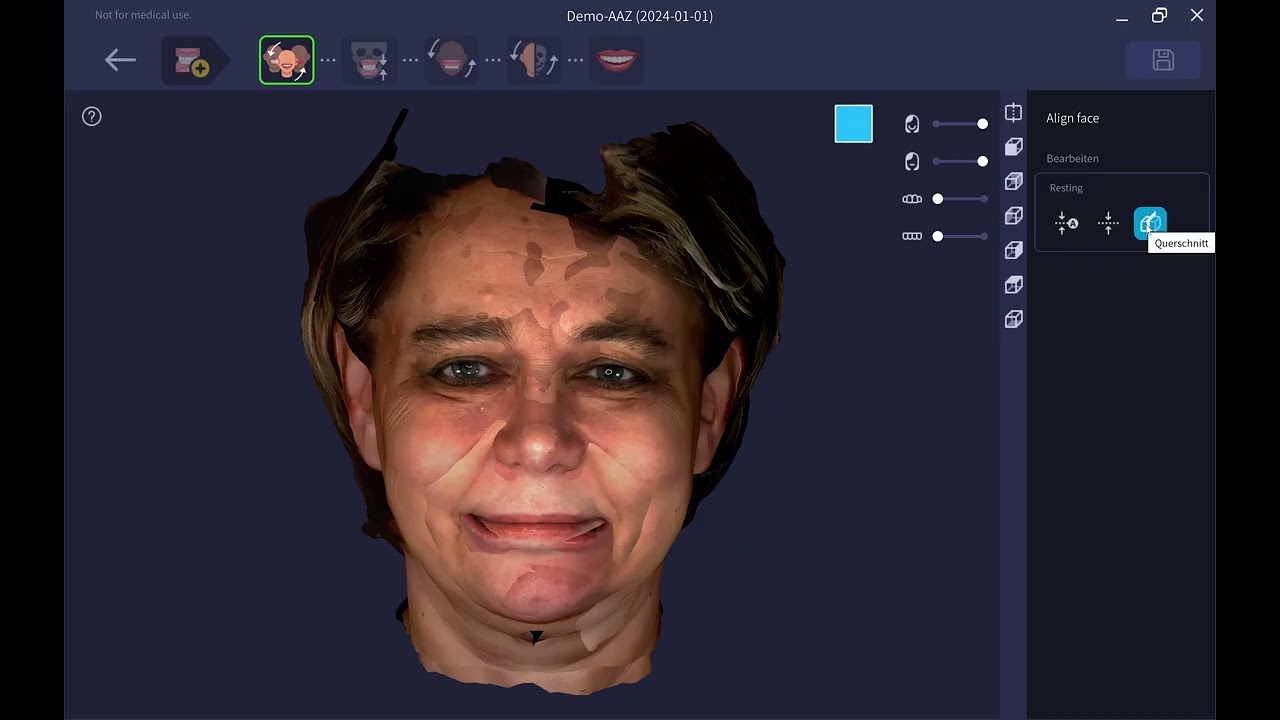 Möglichkeiten des RAYFace 3D-Gesichtsscanners — Dr. Dr. Stephan Weihe